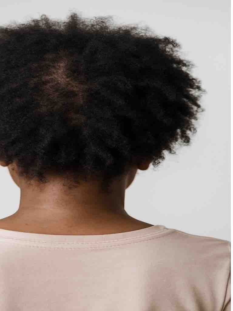 fragilise_avant_final_768x1024